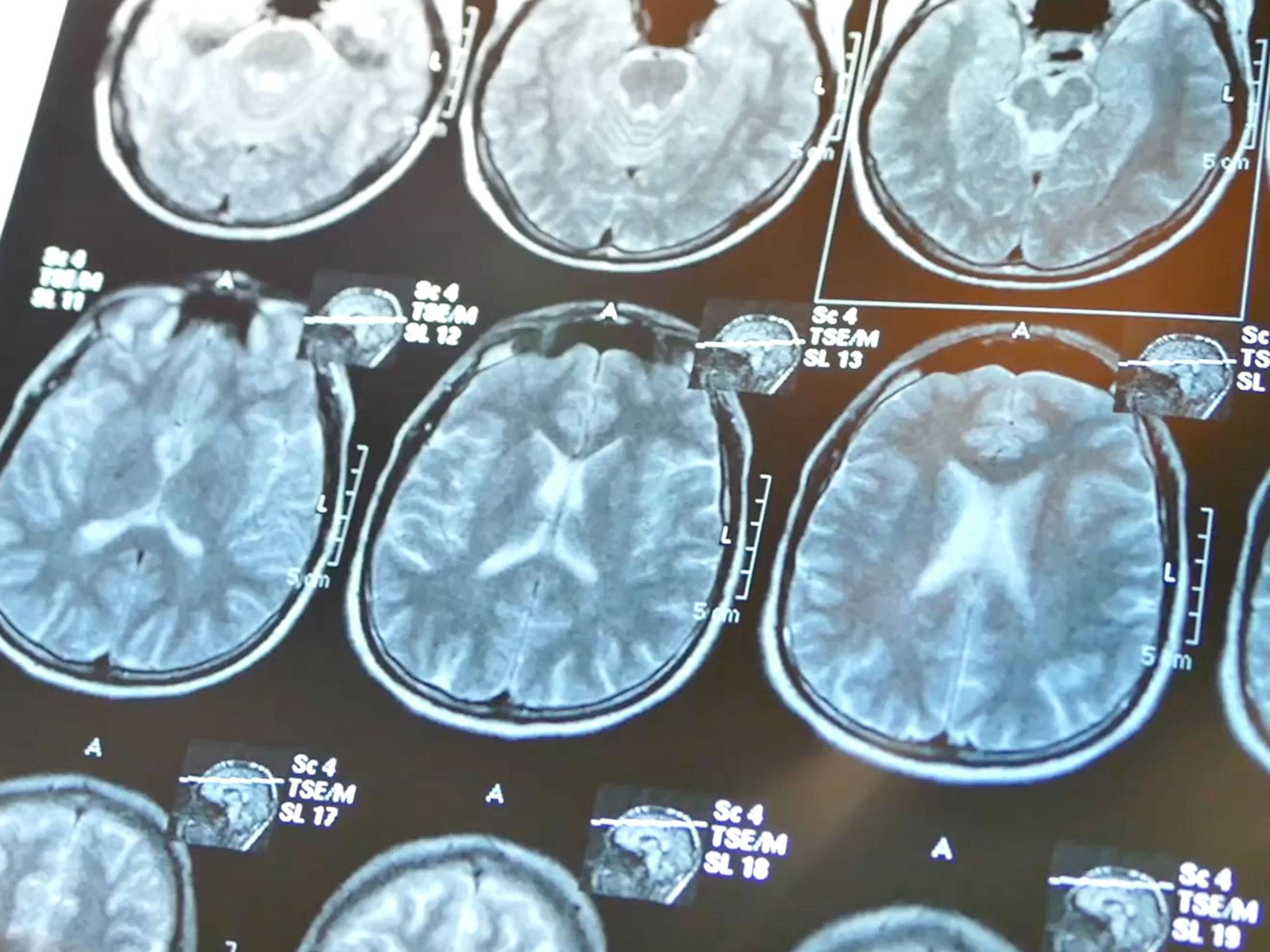 X-Ray images from brain scan